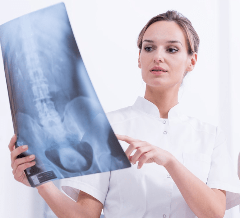 Diagnosi di osteocondrosi toracica mediante esame a raggi X