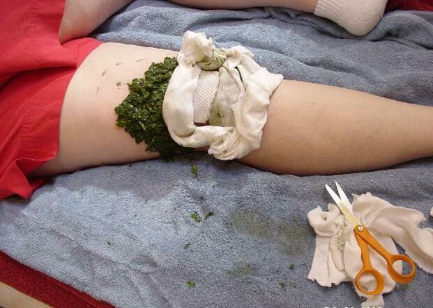 Un impacco caldo di foglie di cavolo schiacciate su un'articolazione del ginocchio dolorante con artrosi