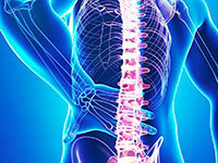 Come curare il mal di schiena